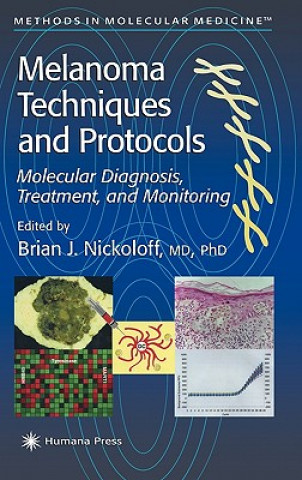 Melanoma Techniques and Protocols