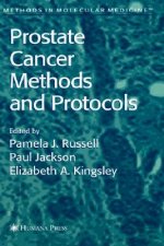 Prostate Cancer Methods and Protocols