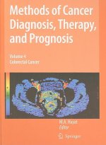 Methods of Cancer Diagnosis, Therapy and Prognosis