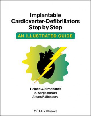 Implantable Cardioverter - Defibrillators Step by Step - An Illustrated Guide