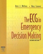 ECG in Emergency Decision Making