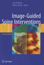 Image-Guided Spine Interventions