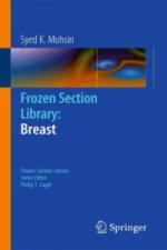 Breast