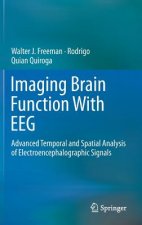 Imaging Brain Function With EEG