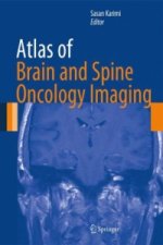 Atlas of Brain and Spine Oncology Imaging