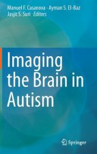 Imaging the Brain in Autism