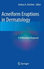 Acneiform Eruptions in Dermatology