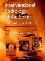 Interventional Radiology of the Spine