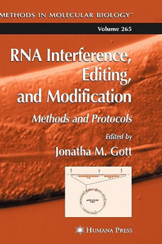 RNA Interference, Editing, and Modification