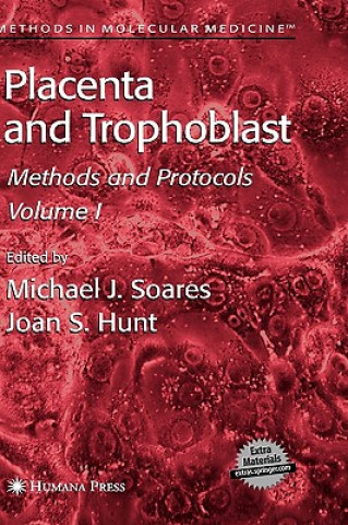 Placenta and Trophoblast