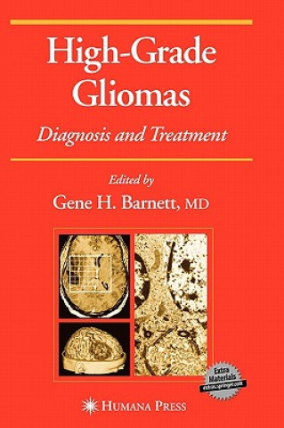 High-Grade Gliomas