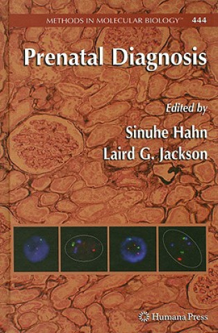 Prenatal Diagnosis
