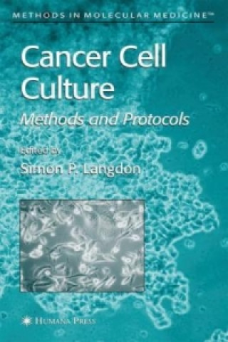 Cancer Cell Culture