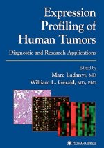 Expression Profiling of Human Tumors