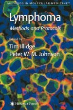 Lymphoma