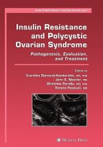 Insulin Resistance and Polycystic Ovarian Syndrome