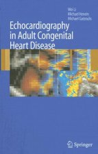 Echocardiography in Adult Congenital Heart Disease