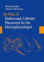 Atlas of Radioscopic Catheter Placement for the Electrophysiologist