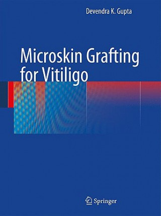 Microskin Grafting for Vitiligo