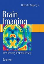Brain Imaging