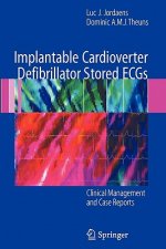 Implantable Cardioverter Defibrillator Stored ECGs