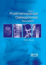 Atlas of Postmenopausal Osteoporosis