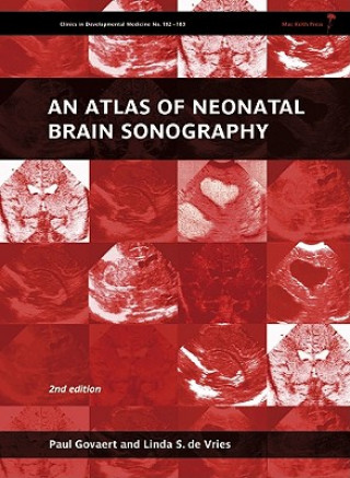 Atlas of Neonatal Brain Sonography - Clinics in Developmental Medicine