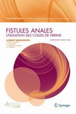 Fistules anales