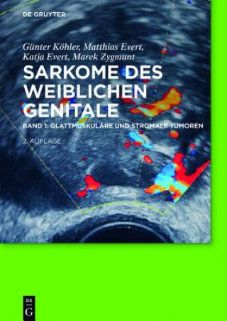 Glattmuskuläre und stromale Tumoren. Bd.1