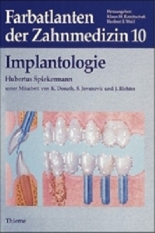Implantologie