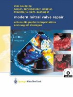 Modern Mitral Valve Repair