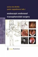 Endoscopic Endonasal Transsphenoidal Surgery
