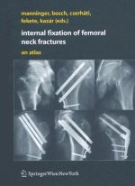 Internal fixation of femoral neck fractures