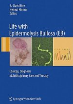 Life with Epidermolysis Bullosa (EB)