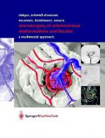 Neurosurgery of Arteriovenous Malformations and Fistulas