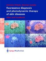 Fluorescence Diagnosis and Photodynamic Therapy of Skin Diseases