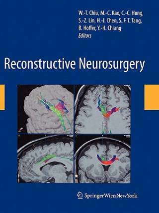 Reconstructive Neurosurgery
