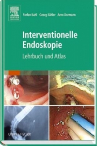 Interventionelle Endoskopie