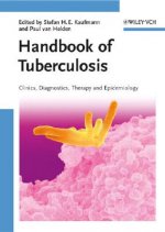 Handbook of Tuberculosis - Clinics, Diagnostics, Therapy and Epidemiology