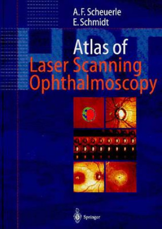 Atlas of Laser Scanning Ophthalmoscopy