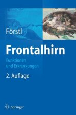 Frontalhirn