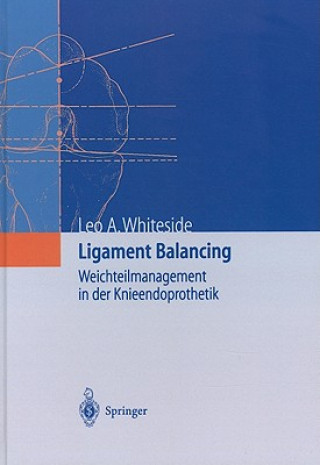 Ligament Balancing