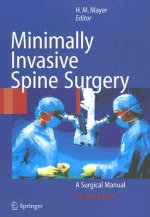 Minimally Invasive Spine Surgery