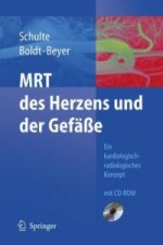MRT des Herzens und der Gefäße, m. CD-ROM