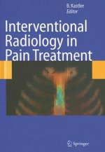 Interventional Radiology in Pain Treatment