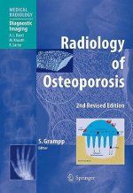 Radiology of Osteoporosis