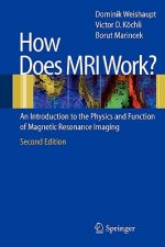 How does MRI work?
