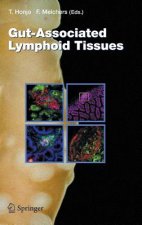 Gut-Associated Lymphoid Tissues