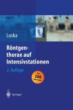 Roentgenthorax auf Intensivstationen