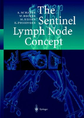 The Sentinel Lymph Node Concept